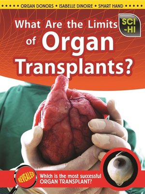 cover image of What Are the Limits of Organ Transplants?